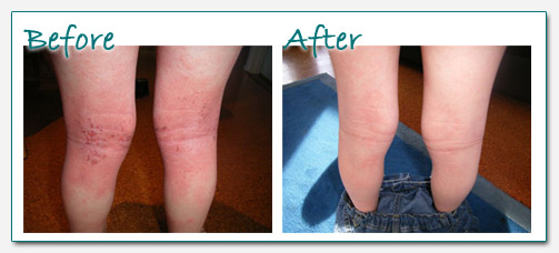 riley-before-after